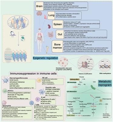 The potential immunological mechanisms of sepsis